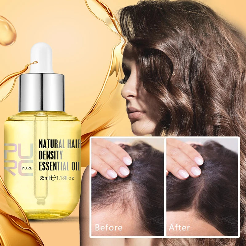 Purc hair density growth products prevent hair loss oil for Men Women